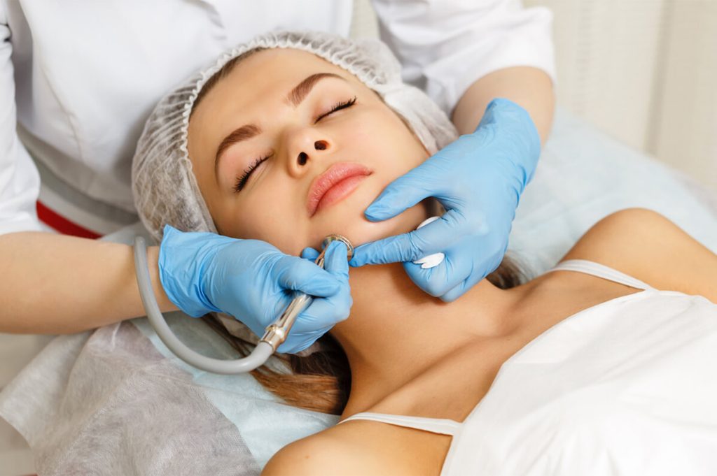 Microdermabrasion treatments 01, Esteem Clinic