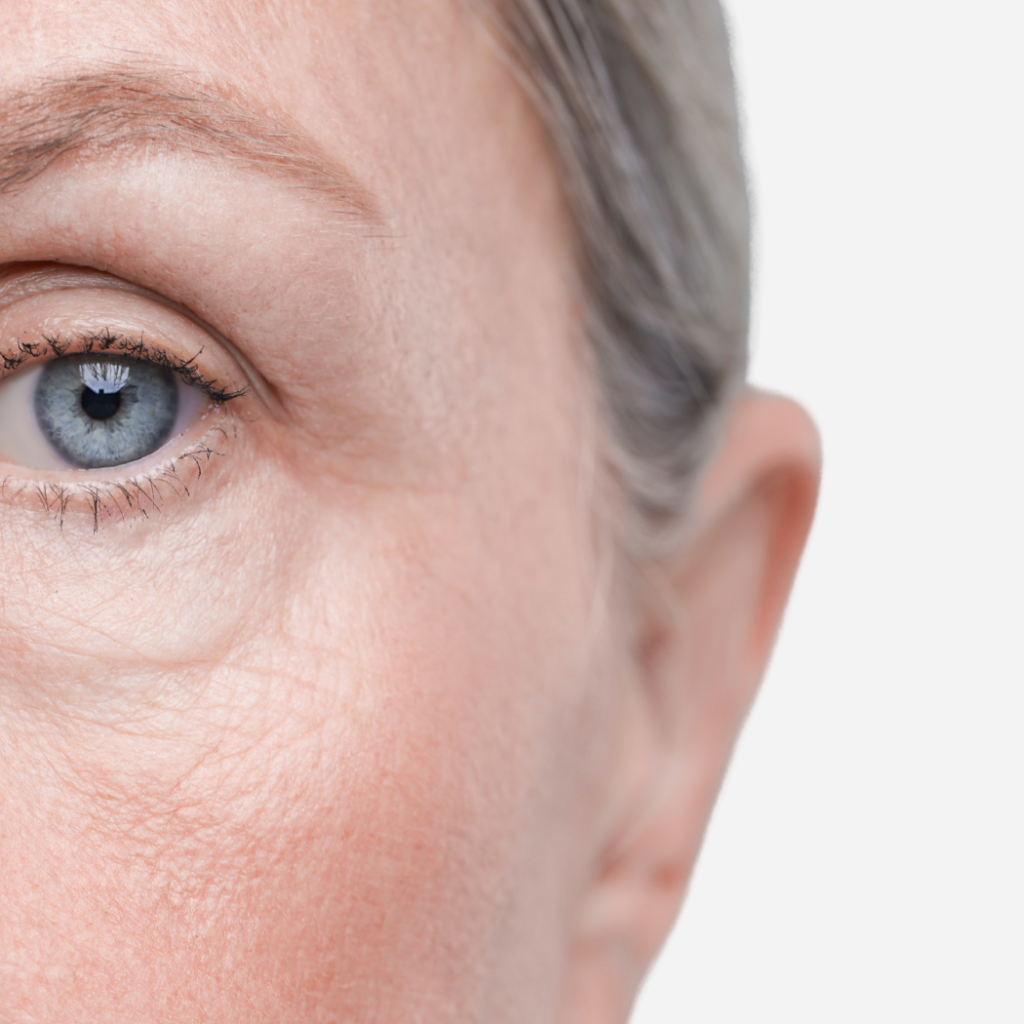 Skin treatments, Microdermabrasion