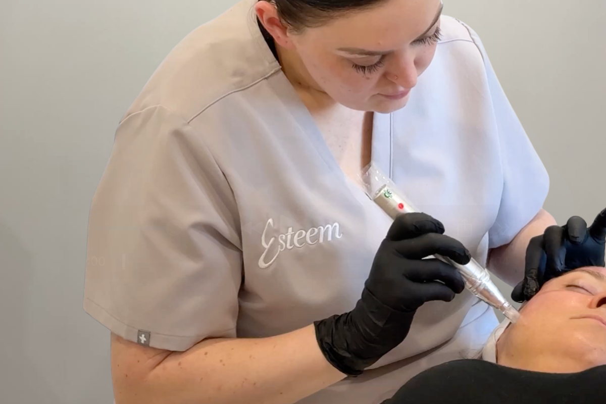 Microneedling Skin Treatment at Esteem Clinic