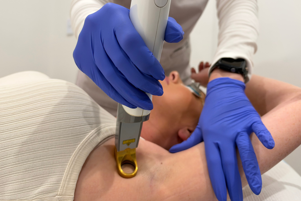 Laser Hair Removal Esteem Clinic