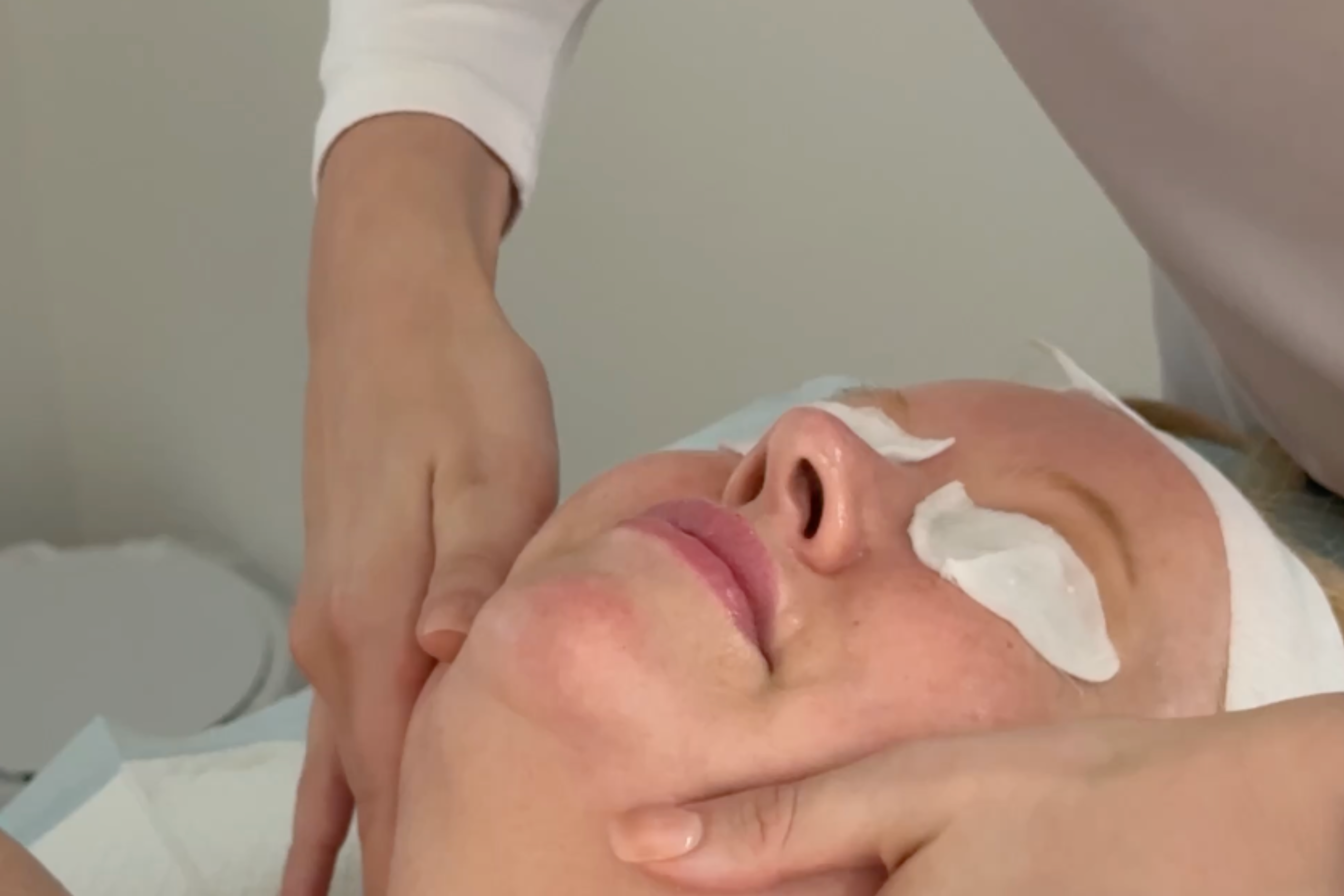 Facial Treatments at Esteem Clinic