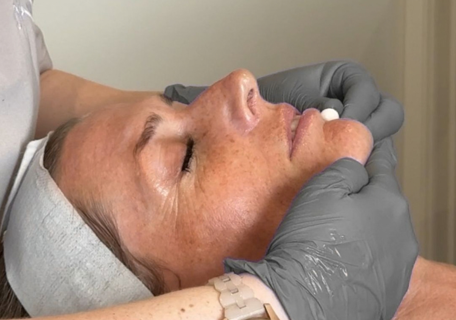 What is skin cycling? - 4 - Esteem Clinic 5 What is skin cycling? - 3
